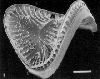 Diatom